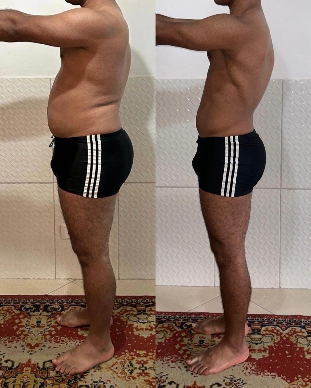 Transformação — paciente com acompanhamento nutricional